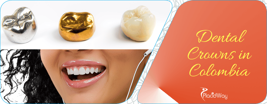 Dental Crowns in Colombia